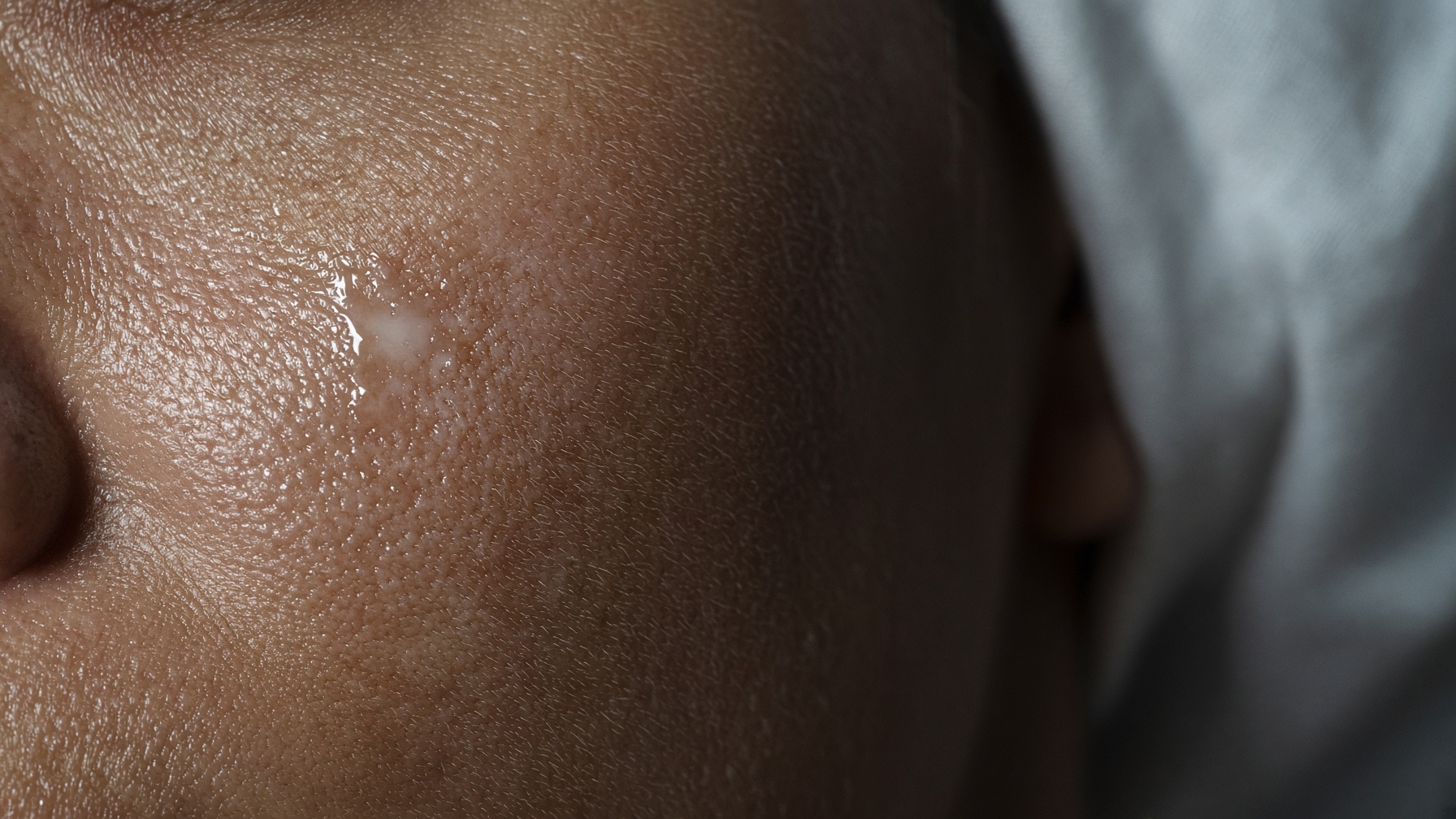 Macro of real skin under directional examination light — pores, a raised spot, and the shine along one cheek